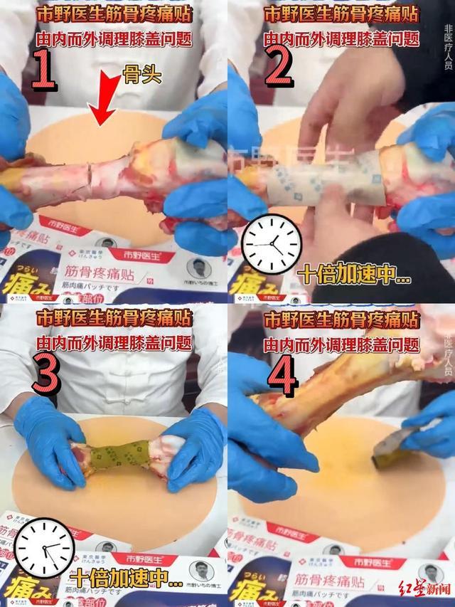 起底爆款“日本专利膏药”市野医生：实为国内生产成本2元(图1)